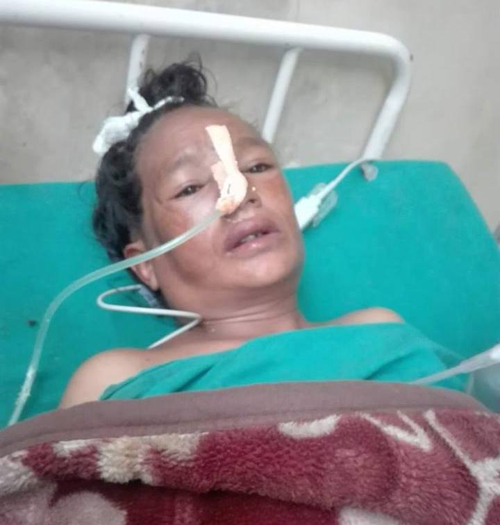 डाक्टर अर्याल टोलीको प्रयासले सुर्पनाले पाईन, पुनर्जन्म