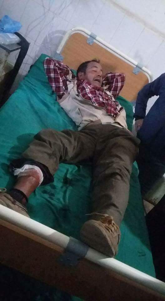 तुलसीपुरमा बम बिस्फोट २ गम्भीर घाइते