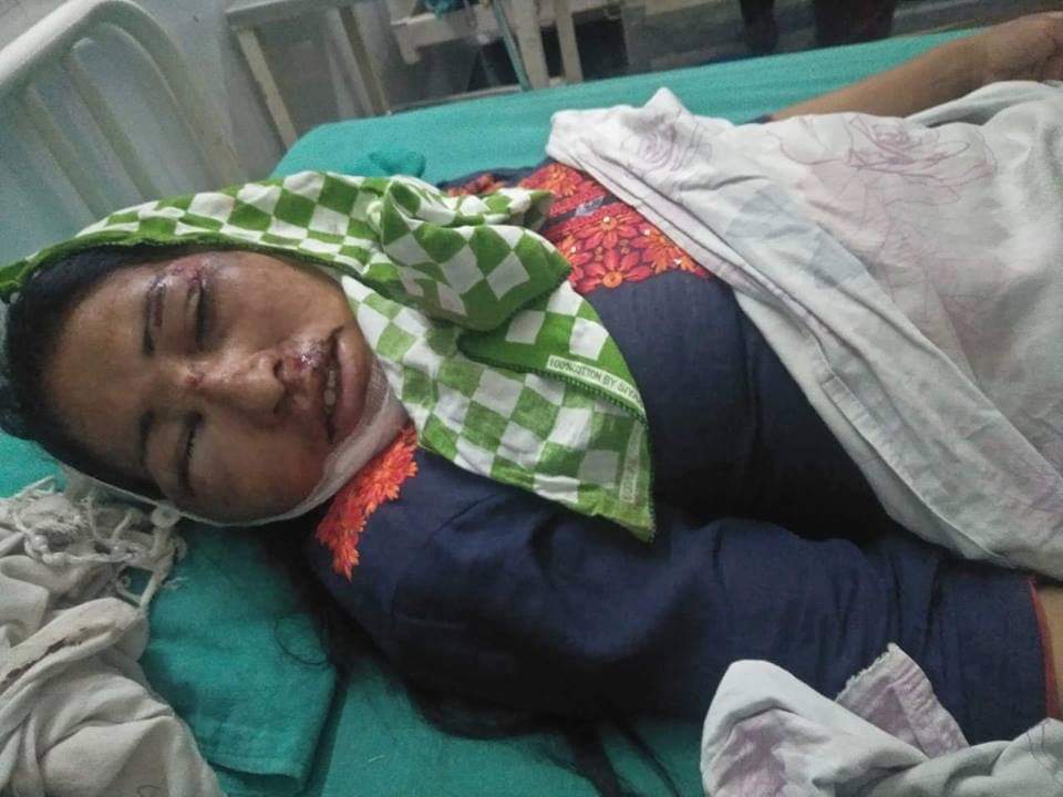 बाँकेको कारकादाेमा बसको ठक्करबाट डोल्पाकी महिला गम्भीर घाईते