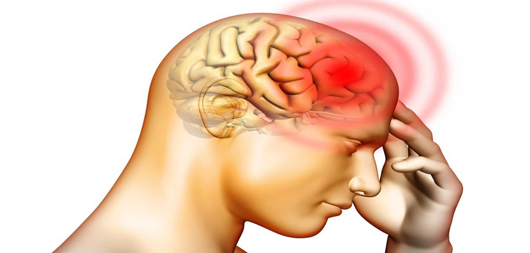 मस्तिष्कघातबाट बच्ने कसरी ?