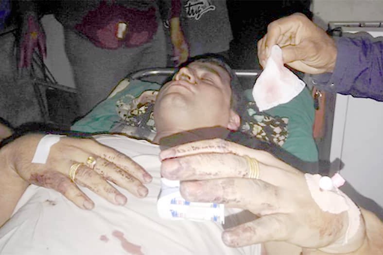 विप्लव समूहको कुटपिबाट गम्भीर घाइते अधिकृतलाई नेपालगन्ज लगियो