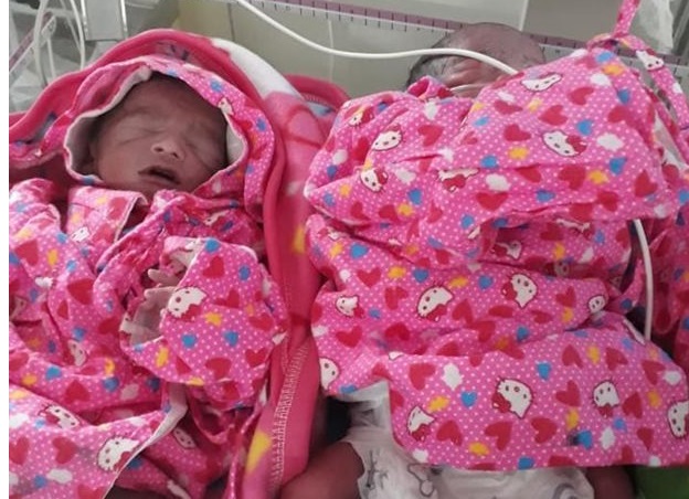 खगित्राले जन्माइन् चम्ल्याहा बच्चा, चिकित्सक भन्छन्- दुर्लभ घटना