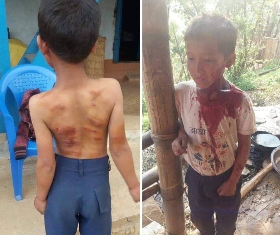 आमाले छोडेर पोइल गइन्, बुबाले कुटेर मरणासन्न बनाए