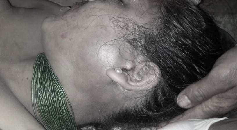 युवतीको संकास्पद मृत्यु प्रकरणमा पुलिसले लिन मानेन जाहेरी